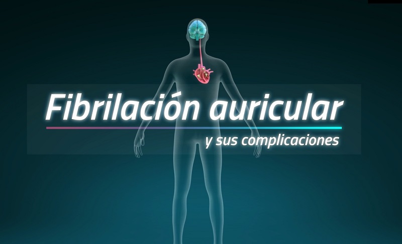 Presentan una nueva opción de tratamiento anticoagulante para la prevención del infarto cerebral